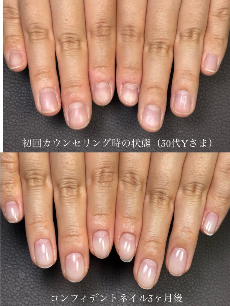 自爪育成サロン 静岡県藤枝市