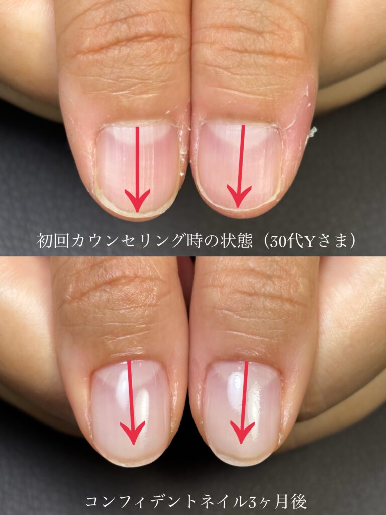 自爪育成ができるネイルサロン静岡県