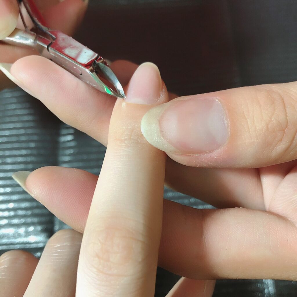 深爪矯正施術風景 静岡県藤枝市ネイルサロン