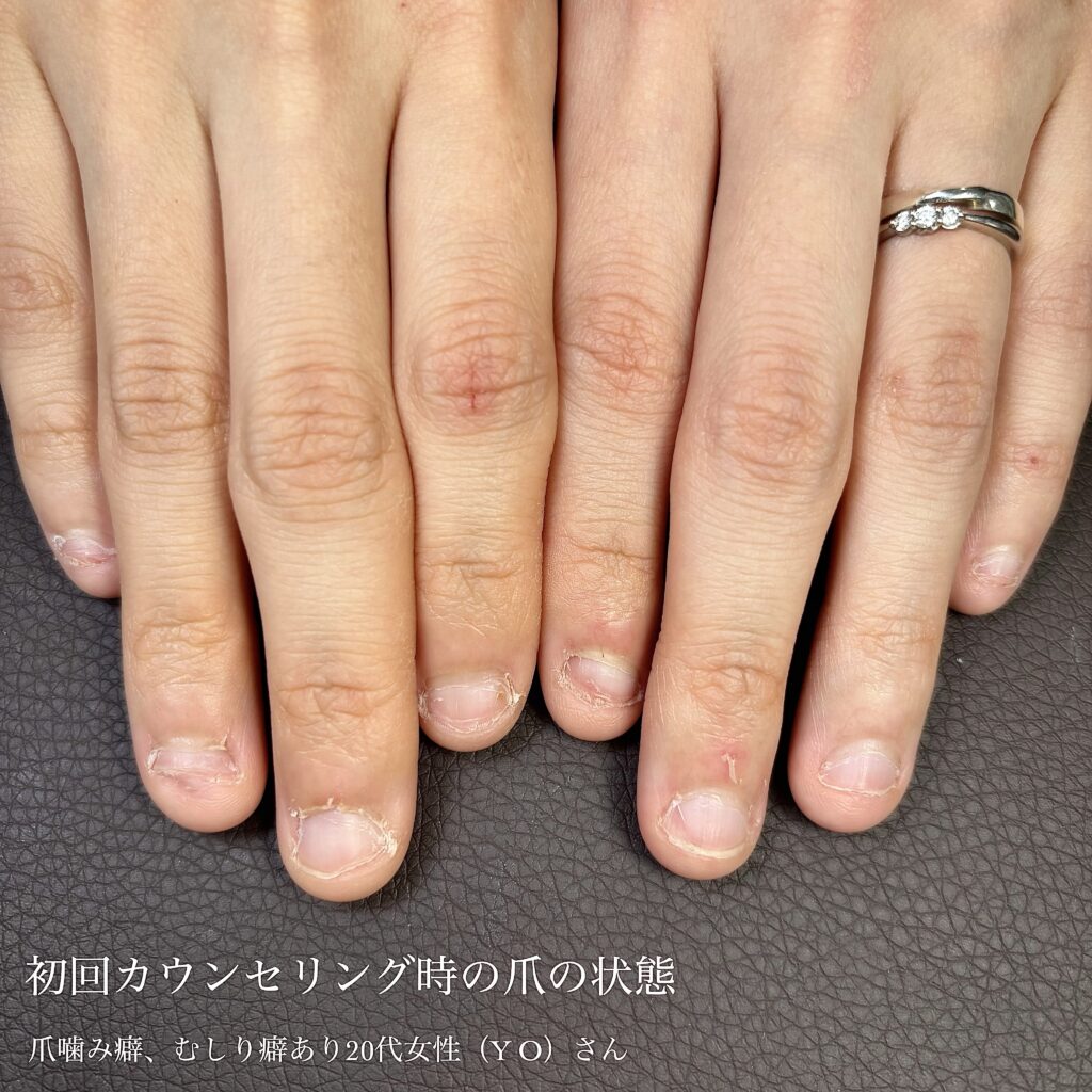 カウンセリング時