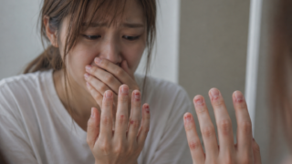 10年間爪や皮膚を噛んでいた看護師さんの変化｜人前で手を隠していた女性が笑顔を取り戻すまで